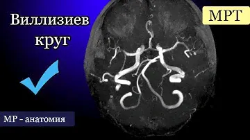 Анатомия магистральных артерий головного мозга на примере нативных МР-артериограмм. Виллизиев круг