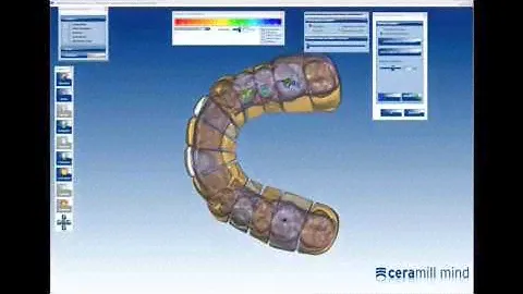 Виртуальный артикулятор ARTEX от Amann Girrbach