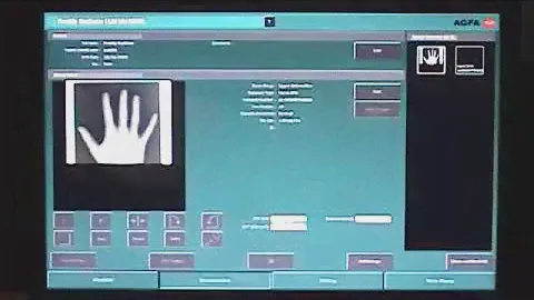 NX