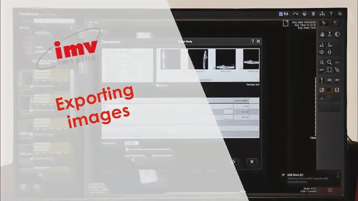 Carestream Image Suite: Exporting images - video 6