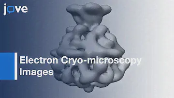 Electron Cryo-microscopy Images of Single Particle Using SPHIRE | Protocol Preview