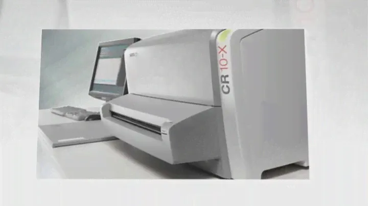 Agfa CR 10-X CR System | Digital Medical Imaging Equipment US$4,320